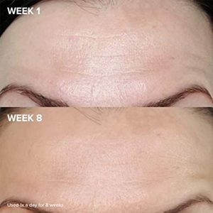 شگفتی رتینول اوردینری